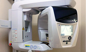 なベラ ビューエポックス3D