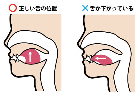 舌の正しい位置