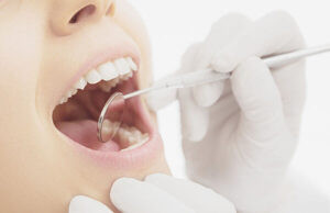 歯科定期健診
